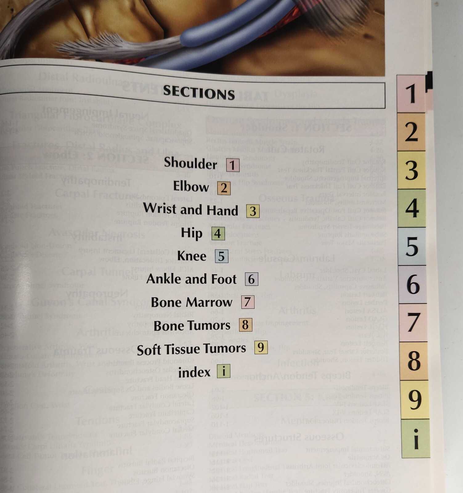 Diagnostic Imaging: Orthopaedics by Stoller, Tirman, Bredella MDRadiology Index